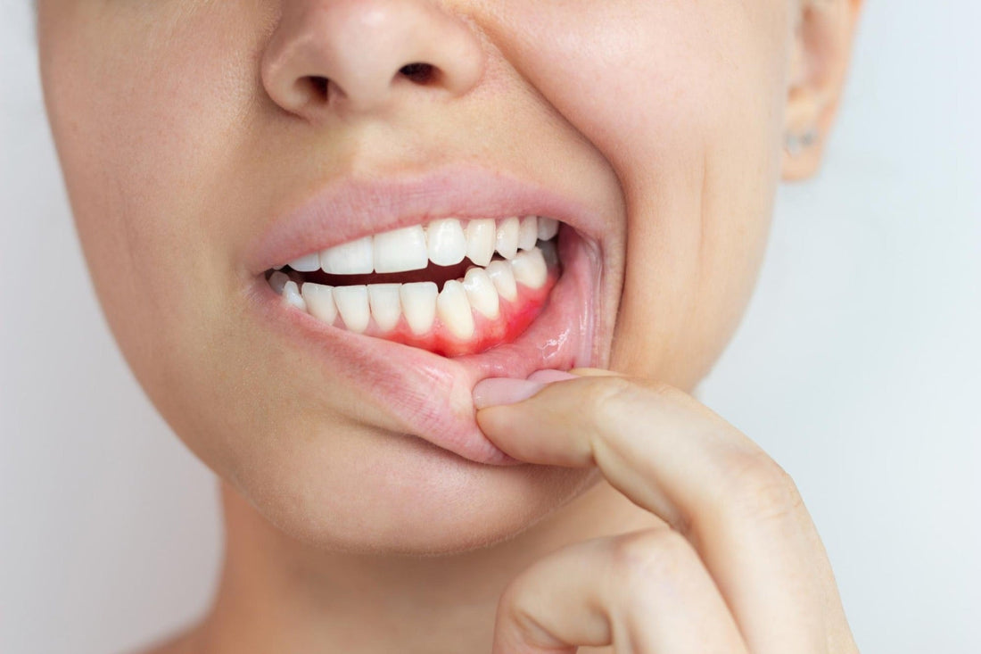 Close-up of inflamed gums